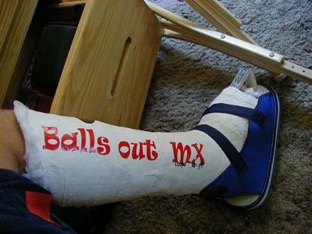 Balls out MX
